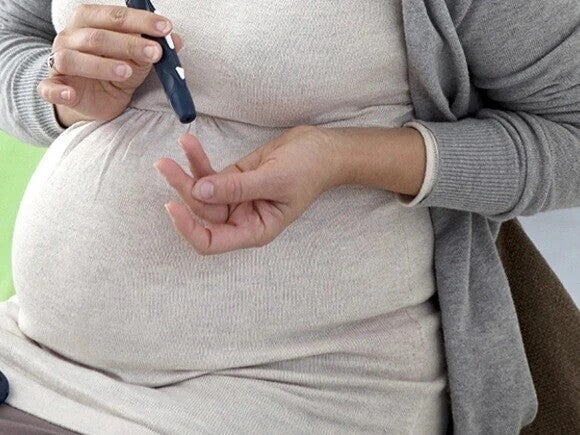 Mujer con Diabetes gestacional